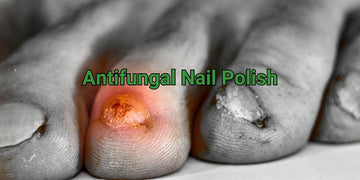 "Say Goodbye to Fungal Nail Infections: Antifungal Nail Polish for Effective Treatment"