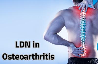 LDN in Osteoarthritis