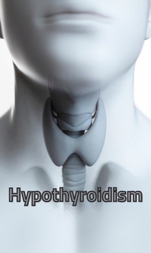 Hypothyroidism 300 × 500