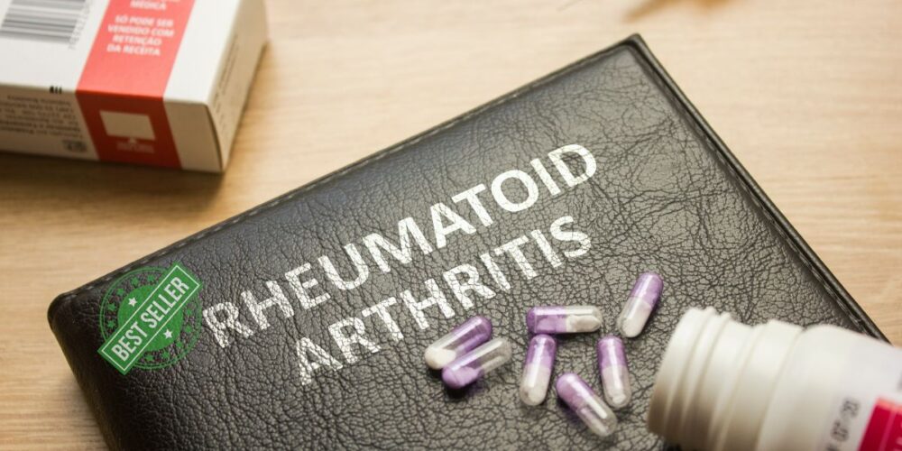 The Best supplements for rheumatoid Arthritis and osteoarthritis