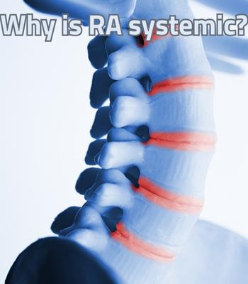 Why RA is considered a systemic disease