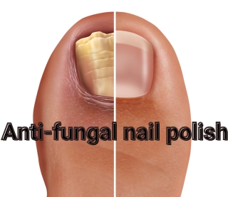 Anti fungal nail polish