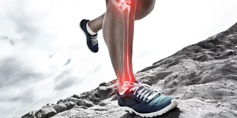 Omega-3s for Joint Health: Key Insights & Benefits